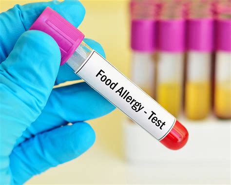 food sensitivity test philippines|Mayo Clinic Q and A: Testing for food allergies and .